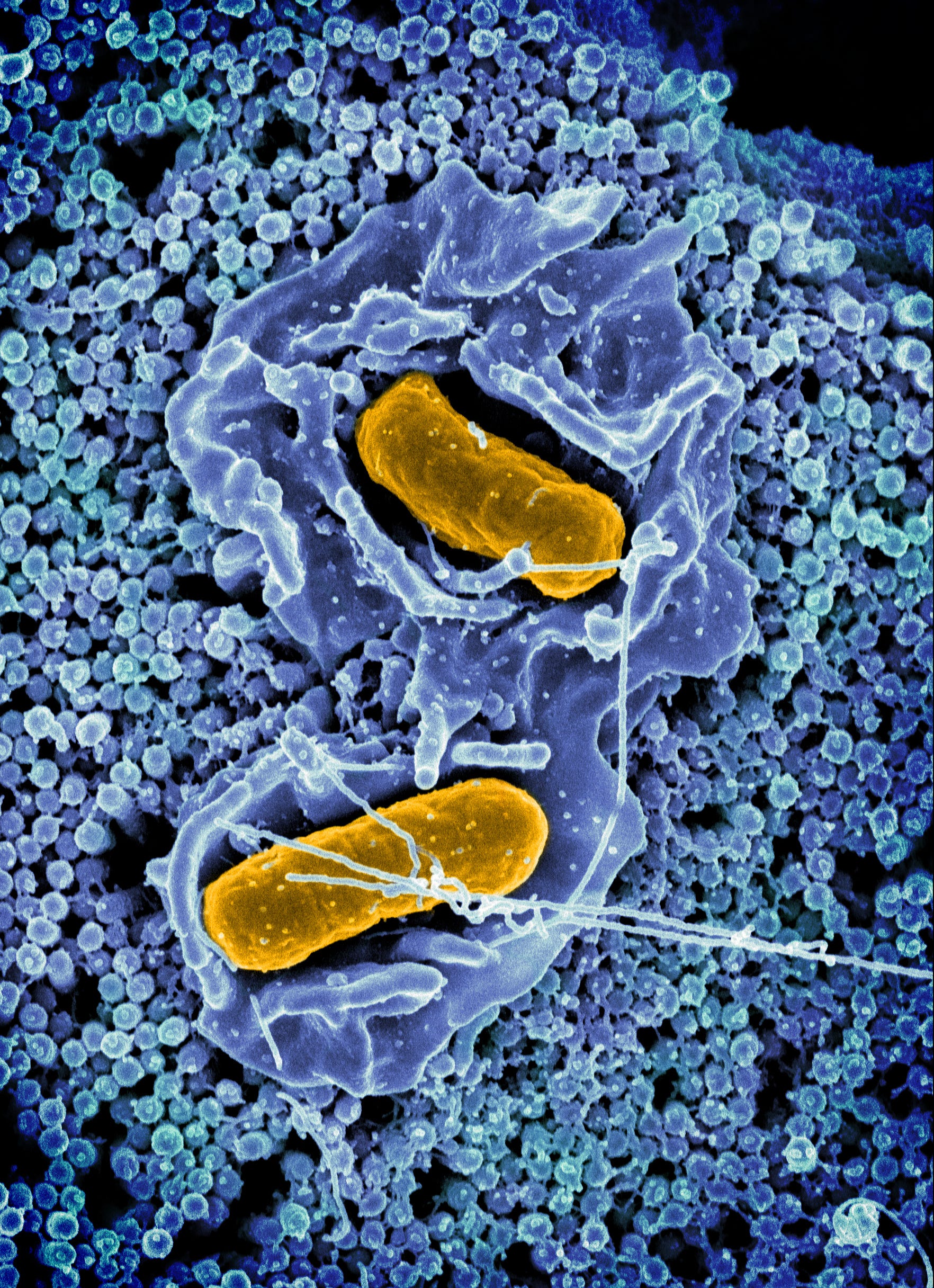 Will The Food Borne Illness Epidemic Ever End?
